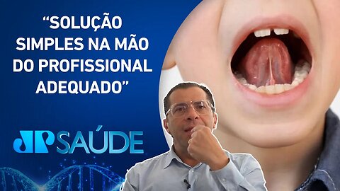 Dificuldade na alimentação e fala pode estar relacionada ao freio lingual | Dr. Salomão Carui