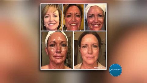 Receive the Skin Regeneration Treatment with Ageless Expressions