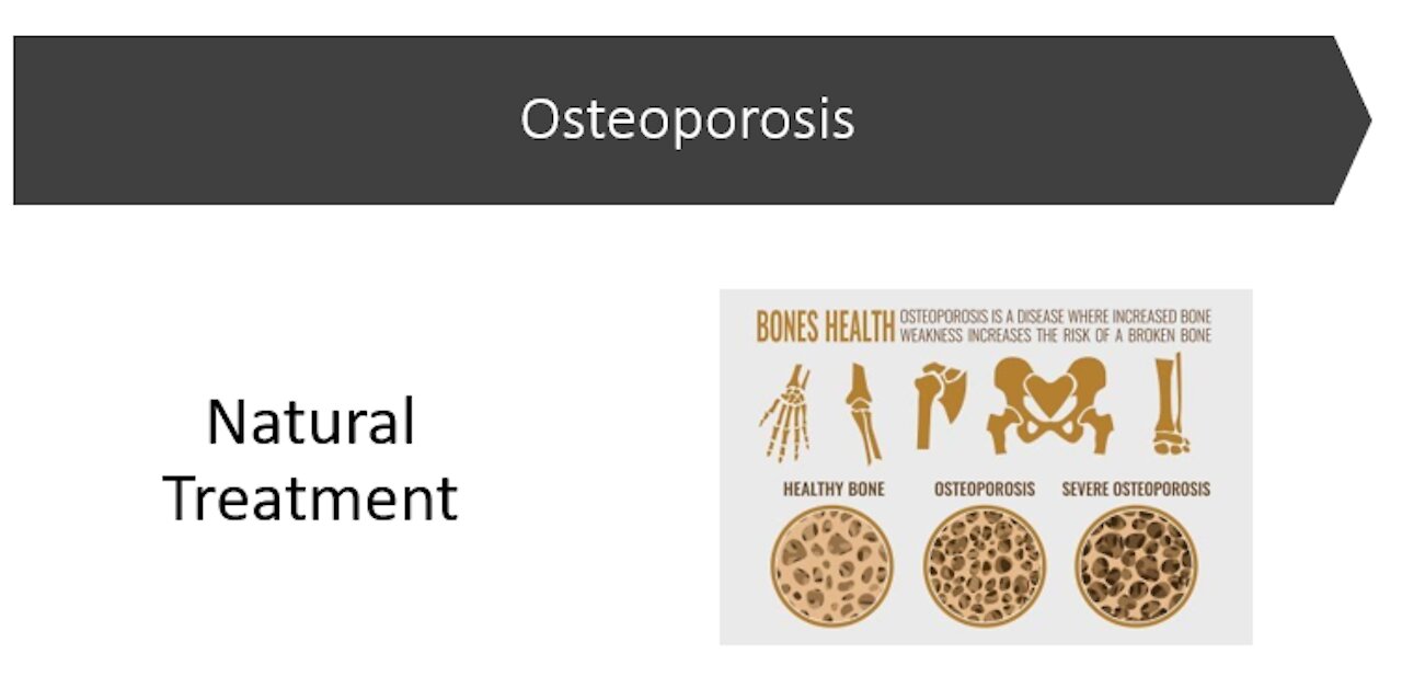 Osteoporosis Natural Treatment