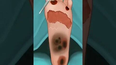 ASMR FOOT TREATMENT ANIMATION#animation #viralvideo #asmr #shortsfeed#viral