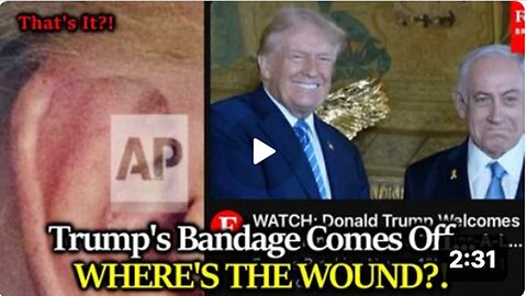 BIG REVEAL Trump's Bandage Comes Off Showing....Where's The Wound?
