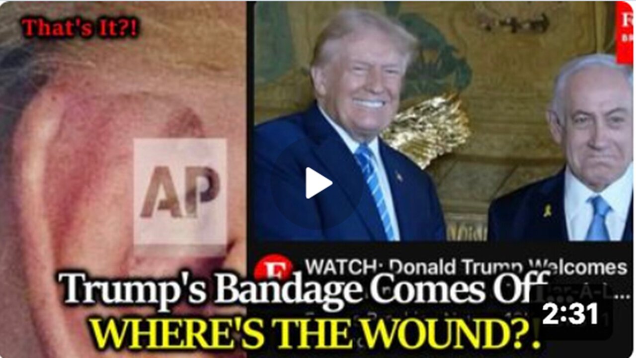 BIG REVEAL Trump's Bandage Comes Off Showing....Where's The Wound?