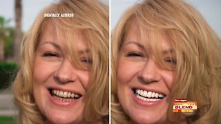 A Whiter Smile With No Messy Strips or Trays