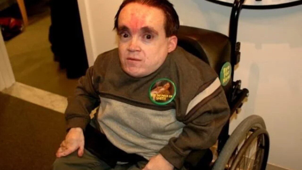 Eric the Midget part A