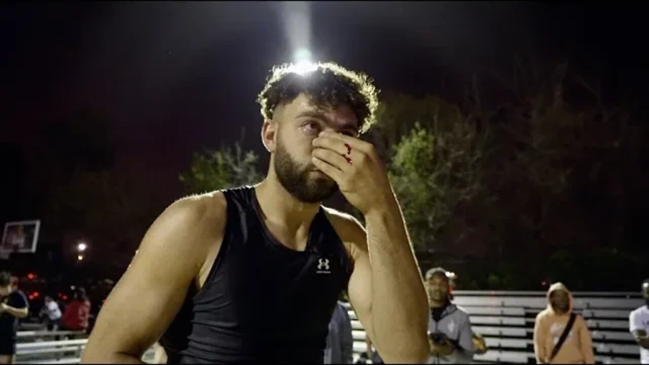 I Broke My Nose At The Park In DC...