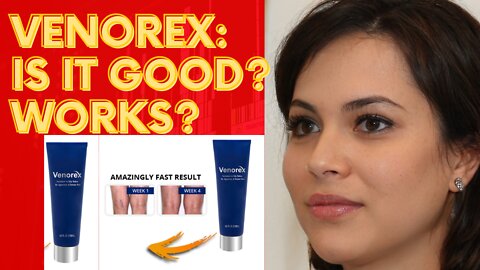 VENOREX: is it good? does it work?