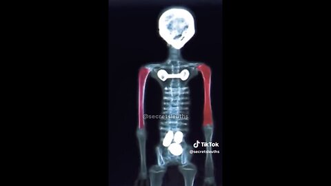 DISCOVERY🌐🛸OF A MYSTERIOUS MEXICO ALIEN🔎👽🔍🌎🛸💫
