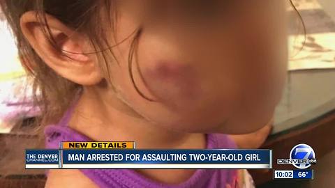 Girl allegedly abused breathing on her own; suspect remains held after first court appearance