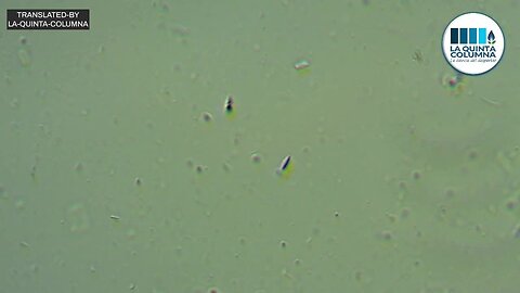 OPTICAL MICROSCOPY study of POLYGONAL STRUCTURES in "covid" inoculums | La Quinta Columna