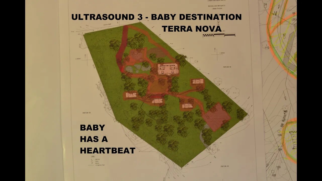 MLG 022 DESTINATION TERRA NOVA Ultrasound 3