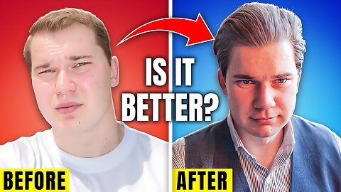 Is Hair Loss Treatment A Better Option Than Hair Transplant?