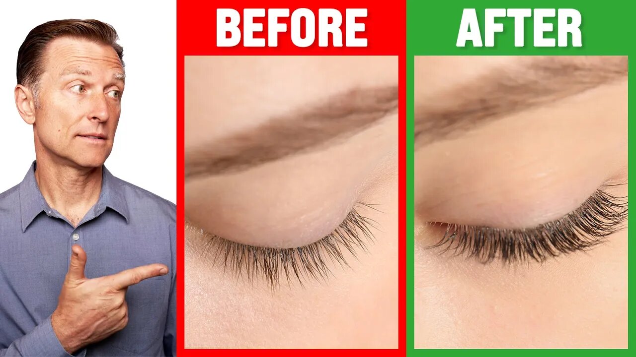 How to Grow Long Thick Eyelashes QUICKLY! - Dr. Berg