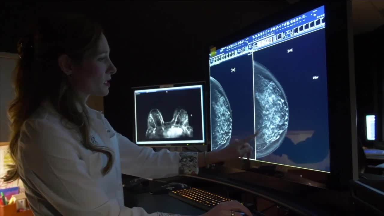 Experts: not enough women are getting a mammography due to COVID-19