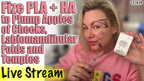 Live Fize PLA + HA to Plump Apples of Cheeks, Labiomandibular Fold & Temples! AceCosm Code Jessica10