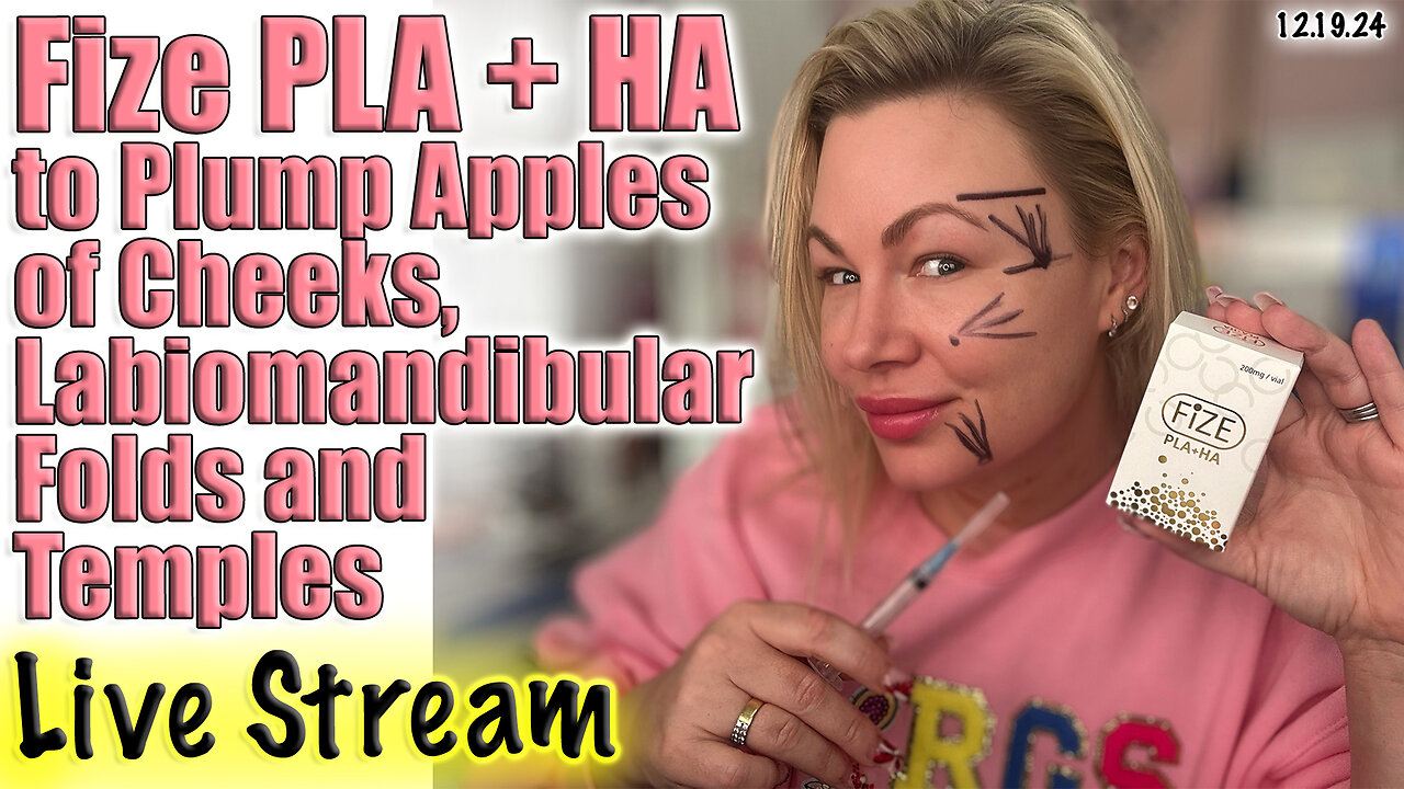 Live Fize PLA + HA to Plump Apples of Cheeks, Labiomandibular Fold & Temples! AceCosm Code Jessica10