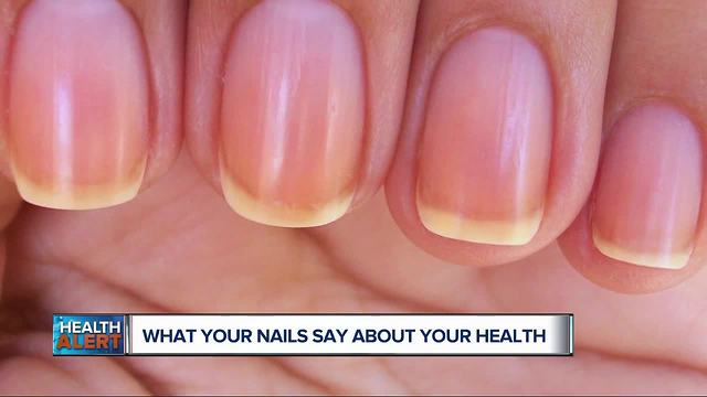 What Your Nails Say About Your Health