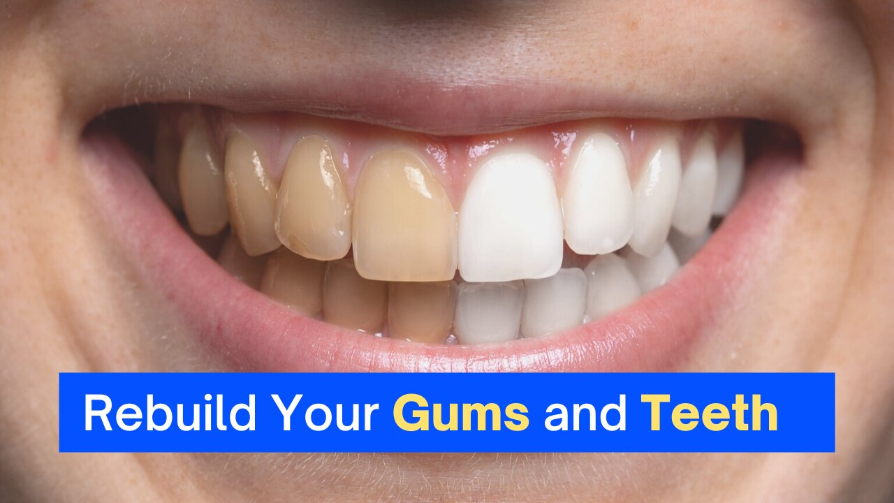 keep your teeth healthy | Rebuild Your Gums and Teeth | best way to have healthy teeth and gums