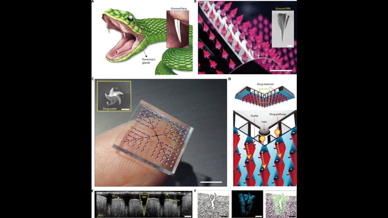 Human Implantable Quantum Dot Microneedle Vaccination System and Luciferase