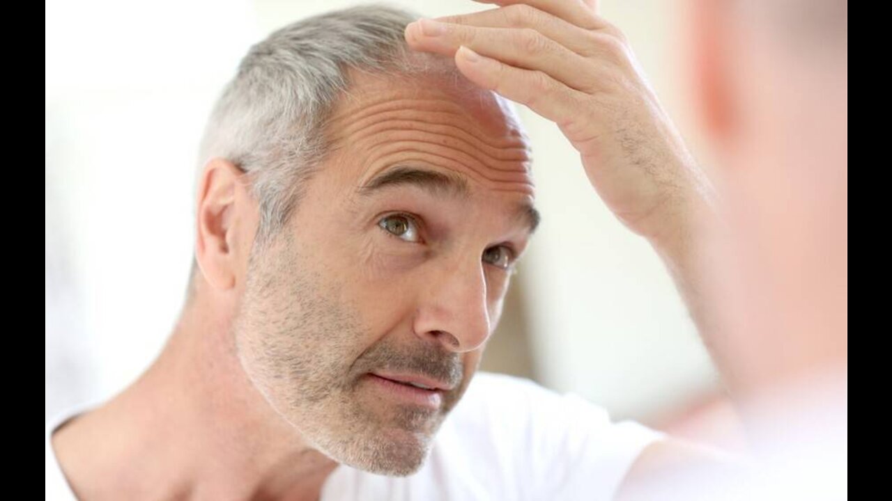 DHT and it's role in hair loss