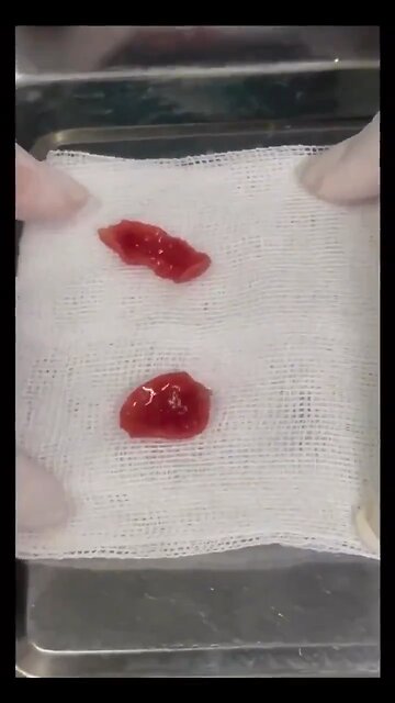 This is a Liver Fluke - found inside humans & animals.