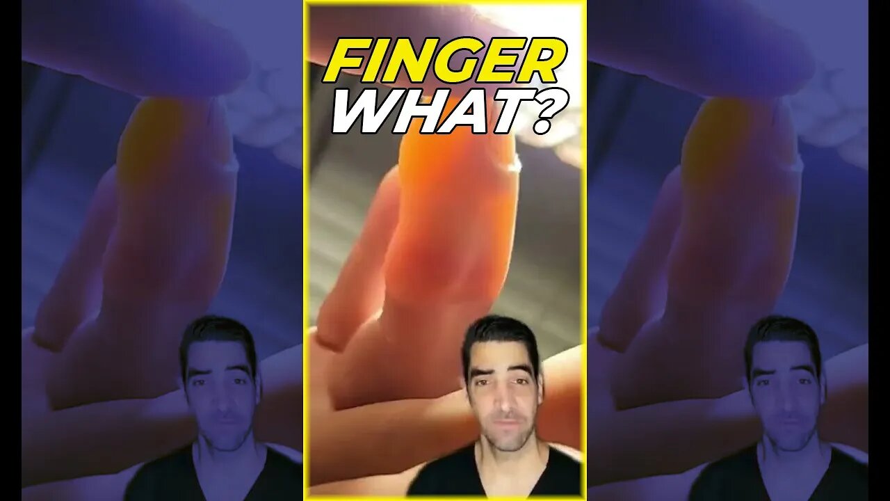 What do you think this is? #Finger