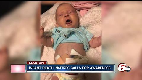 Woman pushes for legislation to educate parents after infant dies from birth defect