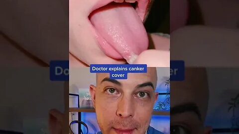 Derm reacts to the canker cover! #cankercover #cankersore #dermreacts