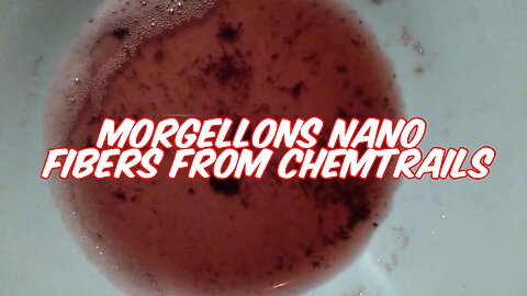 Morgellons Spit Test Nano Fibers From Chemtrails