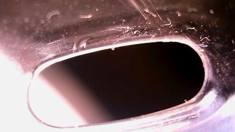 nasty pore digging