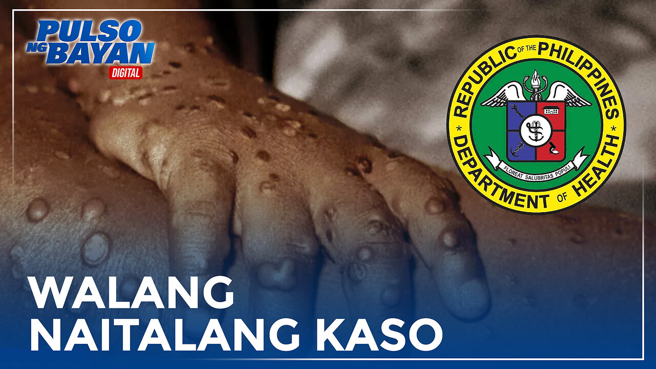 Pilipinas, walang naitalang bagong kaso ng MPOX ayon sa DOH