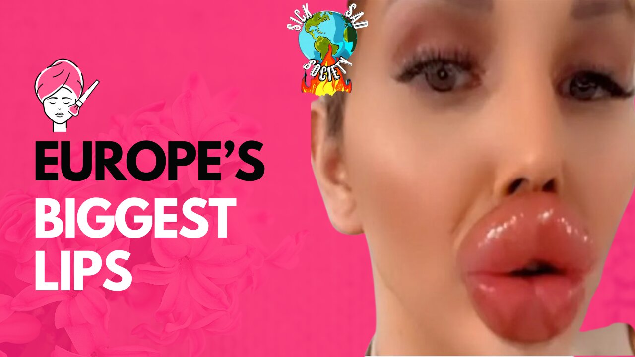 UK's Most Famous Mistress | Europe's 'Biggest Lips' & Other Nonsense