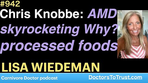 LISA WIEDEMAN a | Chris Knobbe: AMD skyrocketing Why? processed foods