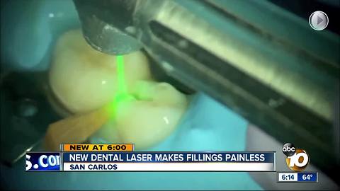 San Carlos Dentist started using it in January