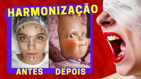 HARMONIZAÇÃO É HORRÍVEL! Pressão ESTÉTICA pra quê? Aqui é CORPO LIVRE! | Harmonização facial RUIM