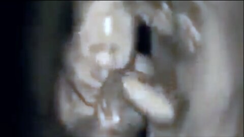 UNBORN HUMAN BABY ACTIVITIES VIEWED UNDER 4-D SCANNER