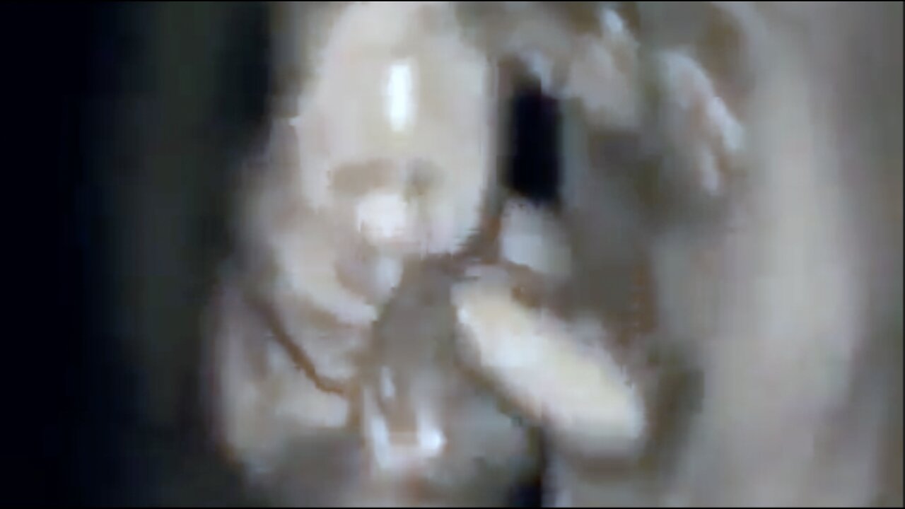 UNBORN HUMAN BABY ACTIVITIES VIEWED UNDER 4-D SCANNER