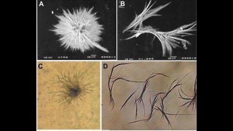 IVERMECTIN ÚČINNÝ AJ NA MORGELONY?