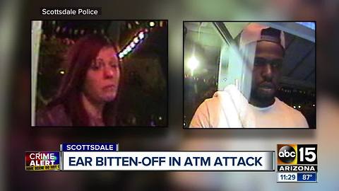 Police: Man's ear bitten off during ATM attack in Scottsdale