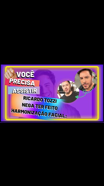 Após especulação o #ator,#RicardoTozzi,nega harmonização facial: 'A cara mudou pelo cabelo.#shorts,