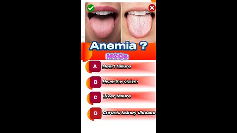 Anemia mcqs #lowblood #hb #infection🧴💊🏥💉 🅾️🩸🆎🅱️🅰️