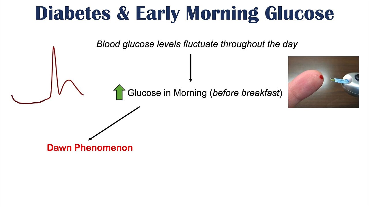 👉High Early Morning Glucose ¦ Dawn Phenomenon & Somogyi Effect