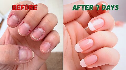 Nail care hacks EVERYONE should know!💅🌷