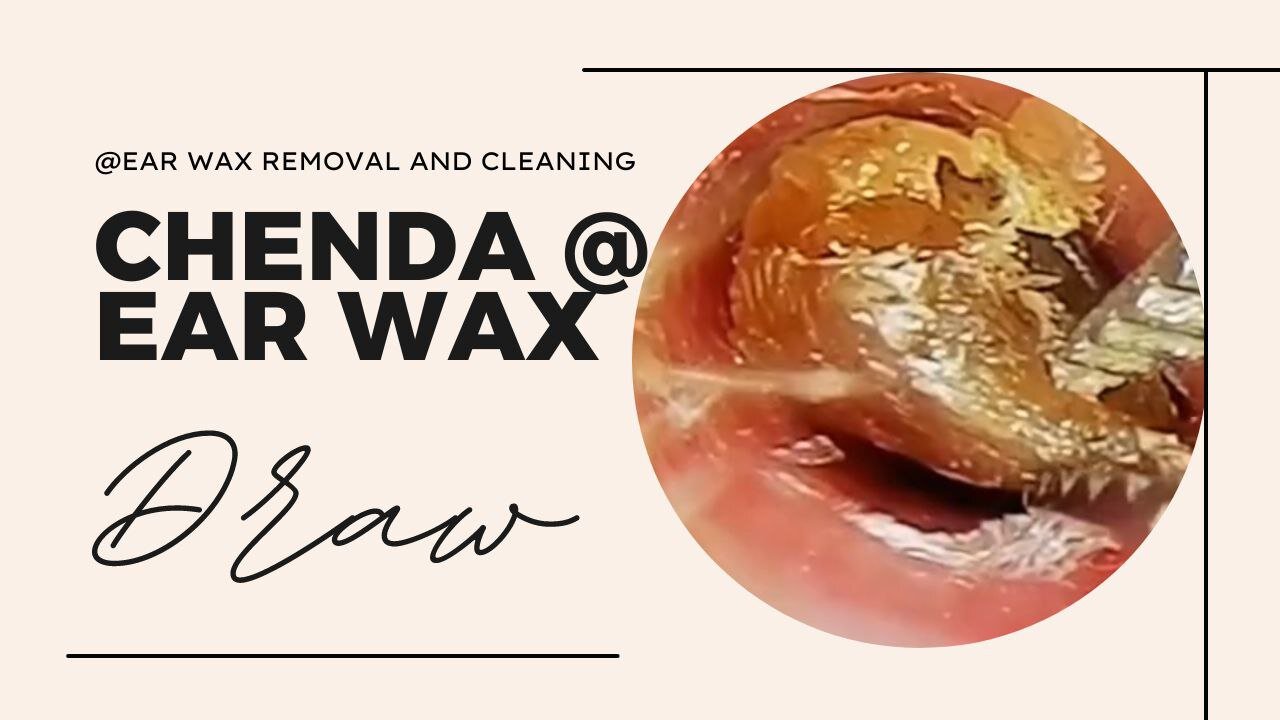 Chenda ear wex removel