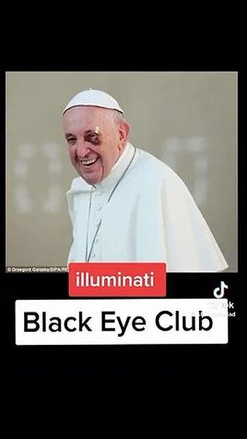 The BLACK EYE Club...