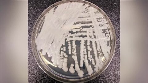 Two cases of Candida Auris reported in Colorado. What it means