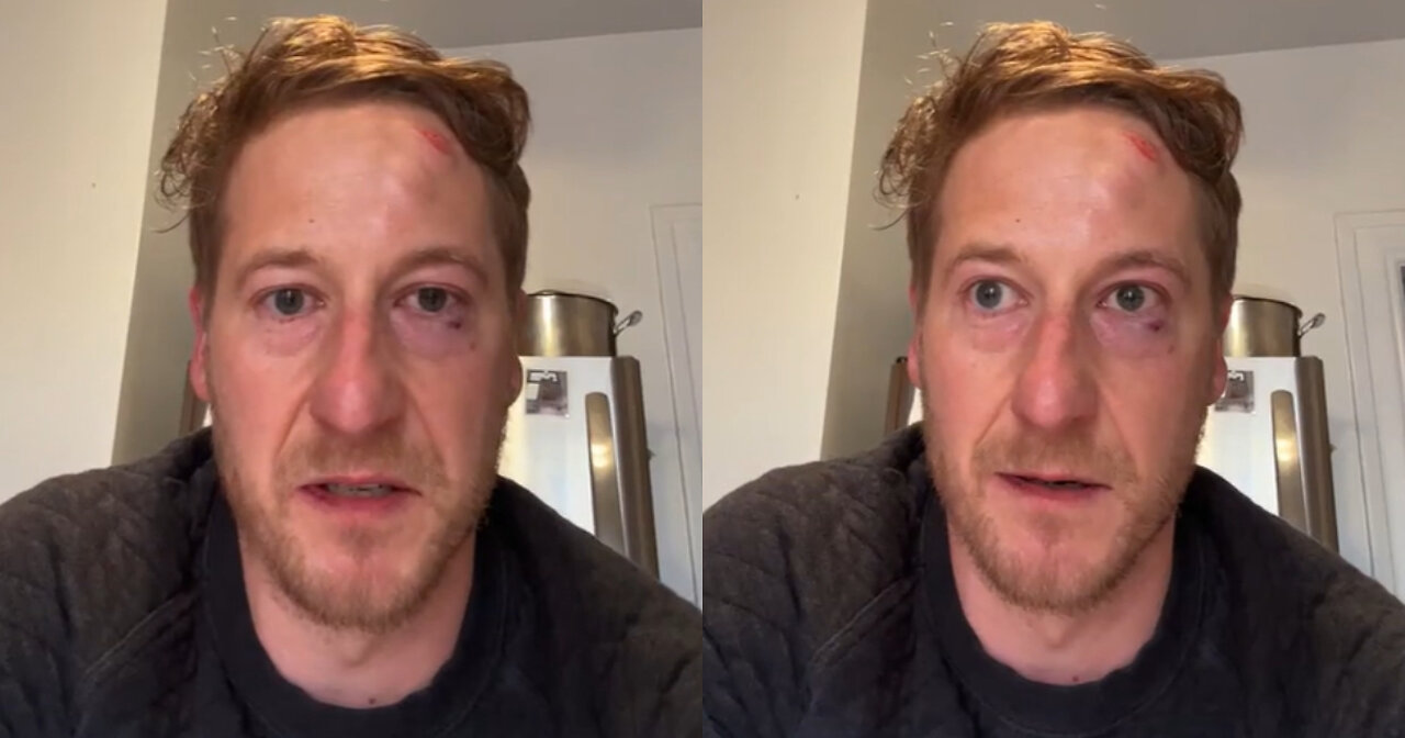 San Francisco Business Owner Unleashes on City Leaders After Being Assaulted by Homeless Man