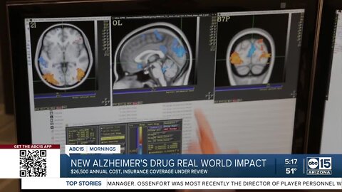 The real world impact of the new Alzheimer's drug