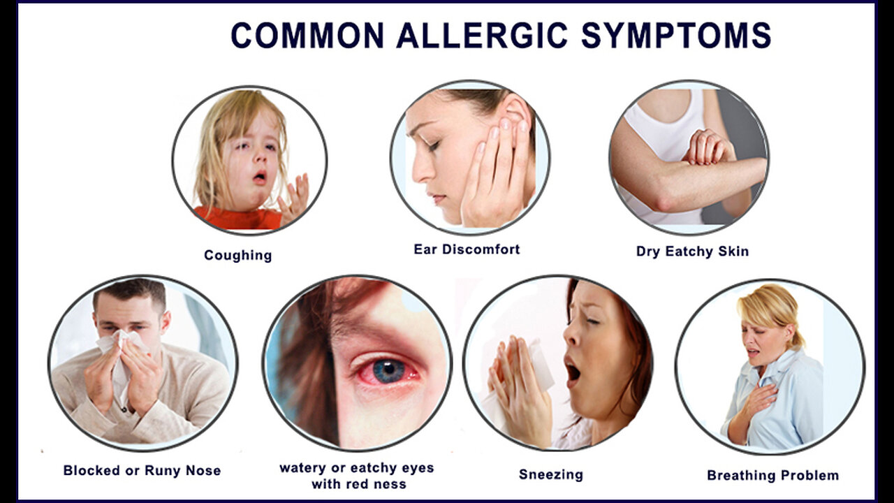 What is allergy, definition & treatment.