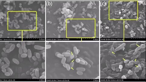 Documentar despre vaccinurile Covid, nanotehnologie și decesele provocate de vaccin
