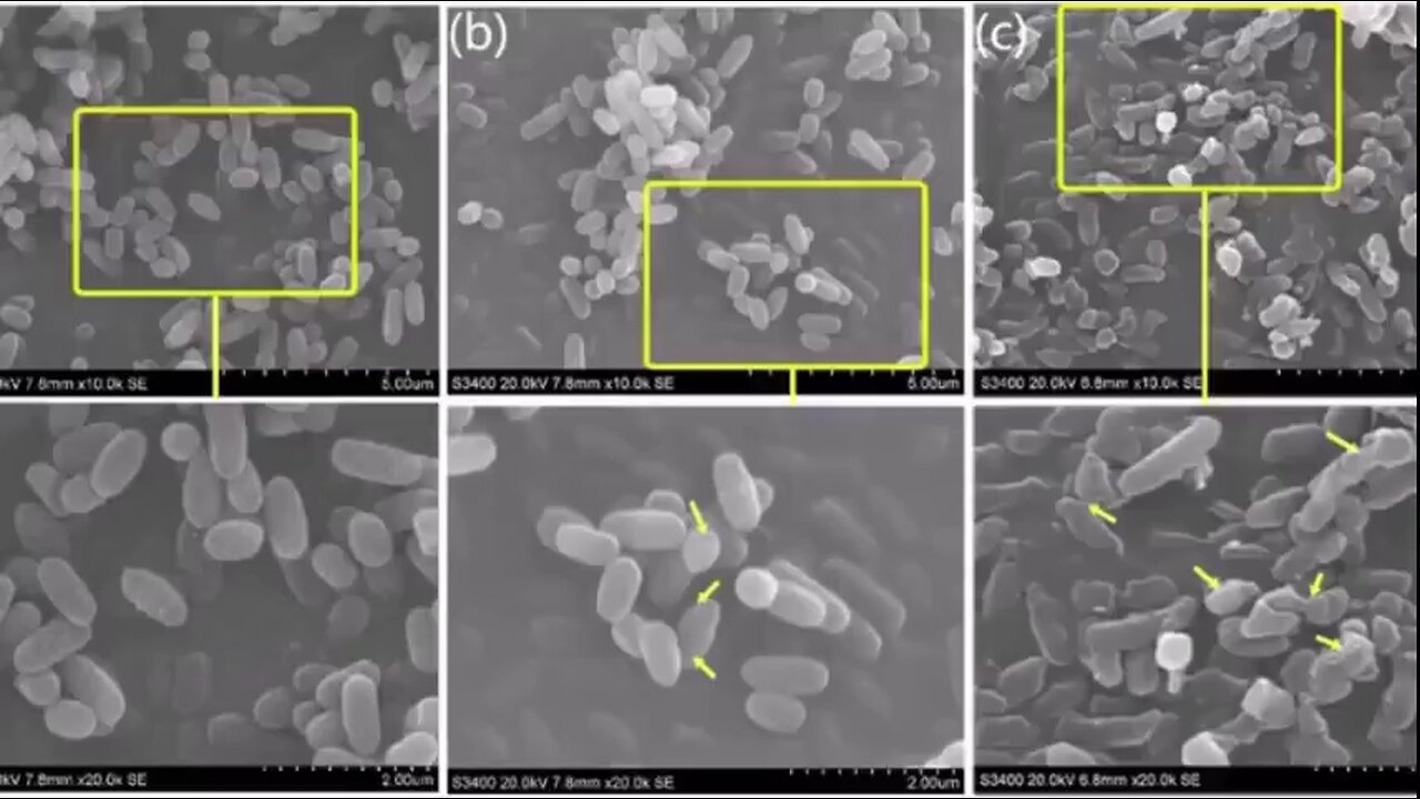Documentar despre vaccinurile Covid, nanotehnologie și decesele provocate de vaccin